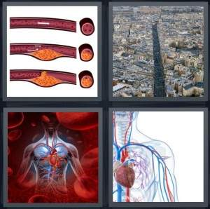 7-letters-answer-artery